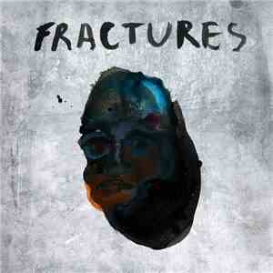 Fractures  - Fractures