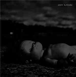 Sore Eyelids - Sore Eyelids