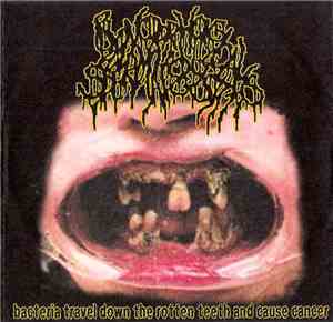 BxSx - Bacteria Travel Down The Rotten Teeth And Cause Cancer