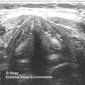 Si Begg - Extreme Vocal Environments