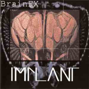 Implant - BrainFX