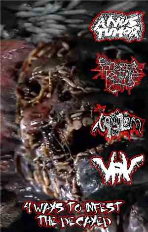 Anus Tumor, Pancreatectomie, Vomitoma, VRV - 4 Ways To Infest The Decayed