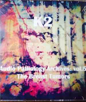 K2 - The Breast Tumors