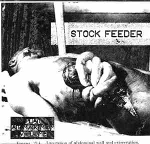Stock Feeder - Laceration Of Abdominal Wall And Evisceration