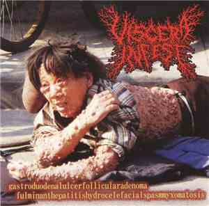 Viscera Infest / Paracoccidioidomicosisproctitissarcomucosis - Gastroduoden ...
