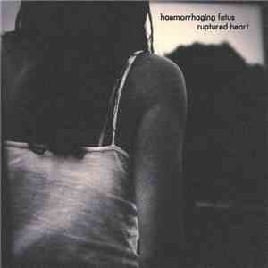 Haemorrhaging Fetus - Ruptured Heart