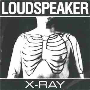 Loudspeaker - X-Ray