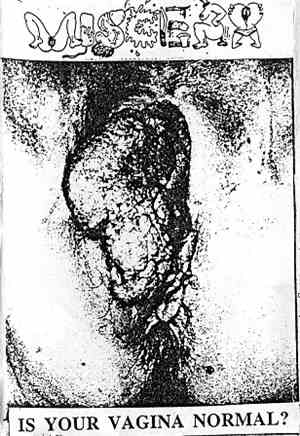Viscera  - Is Your Vagina Normal?