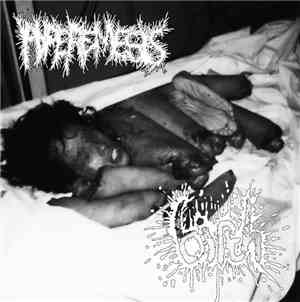 Hyperemesis / Birth  - Pieces