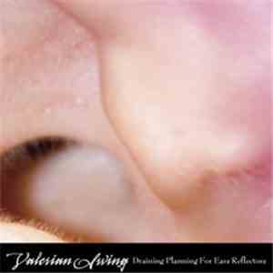 Valerian Swing - Draining Planning For Ears Reflectors