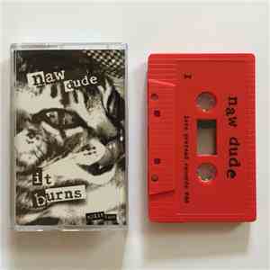 It Burns / Naw Dude - Split Tape