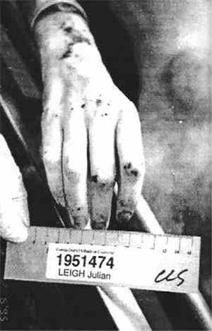 Mourmansk 150 - Autopsy