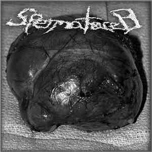 Spermatocele - Spermatocele