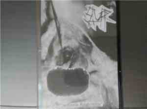 Slurp , Diphyllobothriasis - Cachexia Epiglottitis