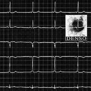 DENSO - 070317 / Aritmie