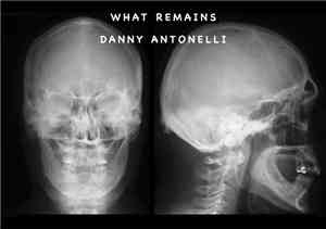 Danny Antonelli - What Remains